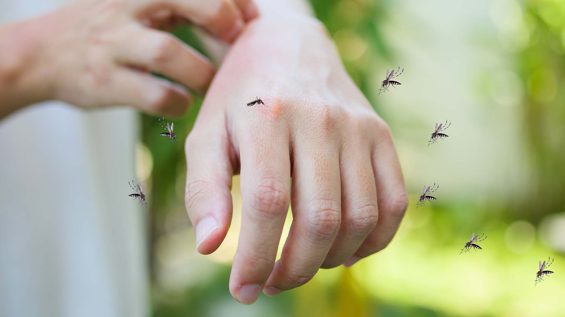 mosquitoes biting around hands