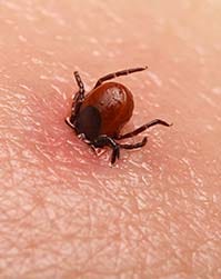 tick bites