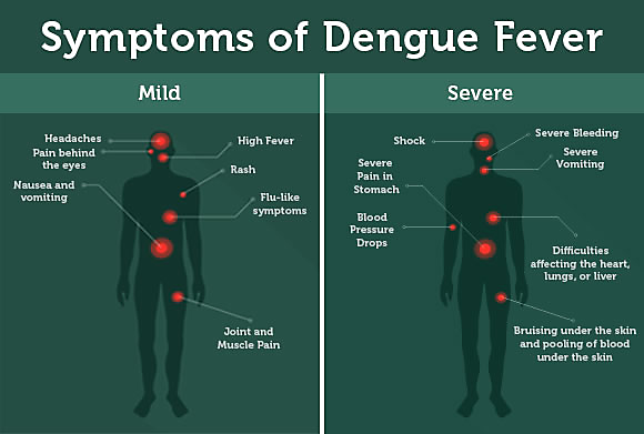 Dengue Fever Symptoms